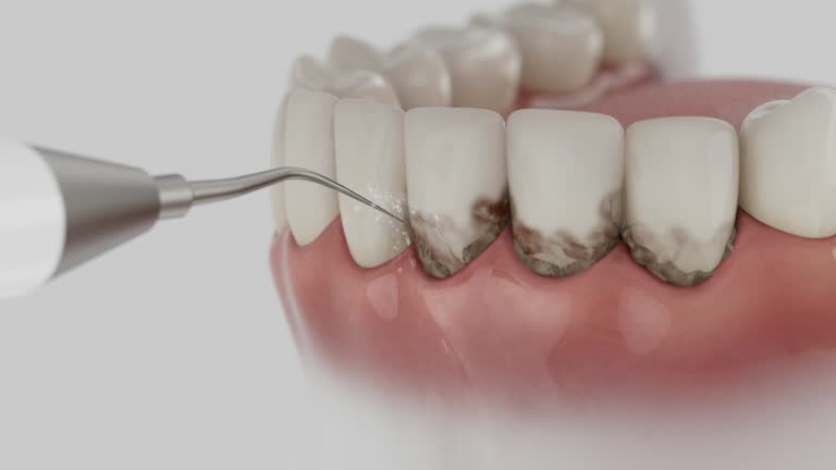 Reliable Dental contractor in Fetters Hot Springs-Agua Caliente, CA by Dentist Open Now